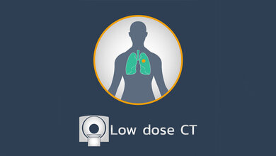 Low Dose CT für die Lunge