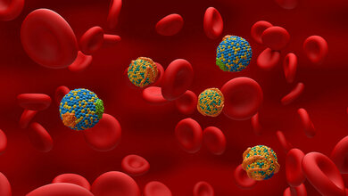 Ungünstige Cholesterinwerte verdoppeln das Risiko für einen Schlaganfall.