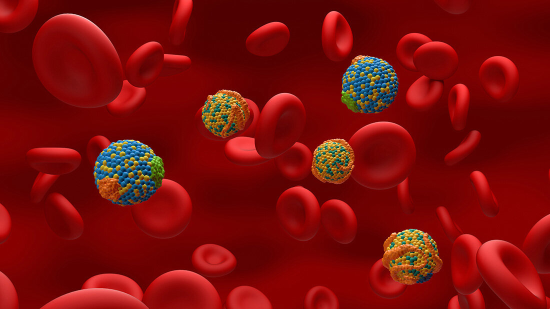 Ungünstige Cholesterinwerte verdoppeln das Risiko für einen Schlaganfall.