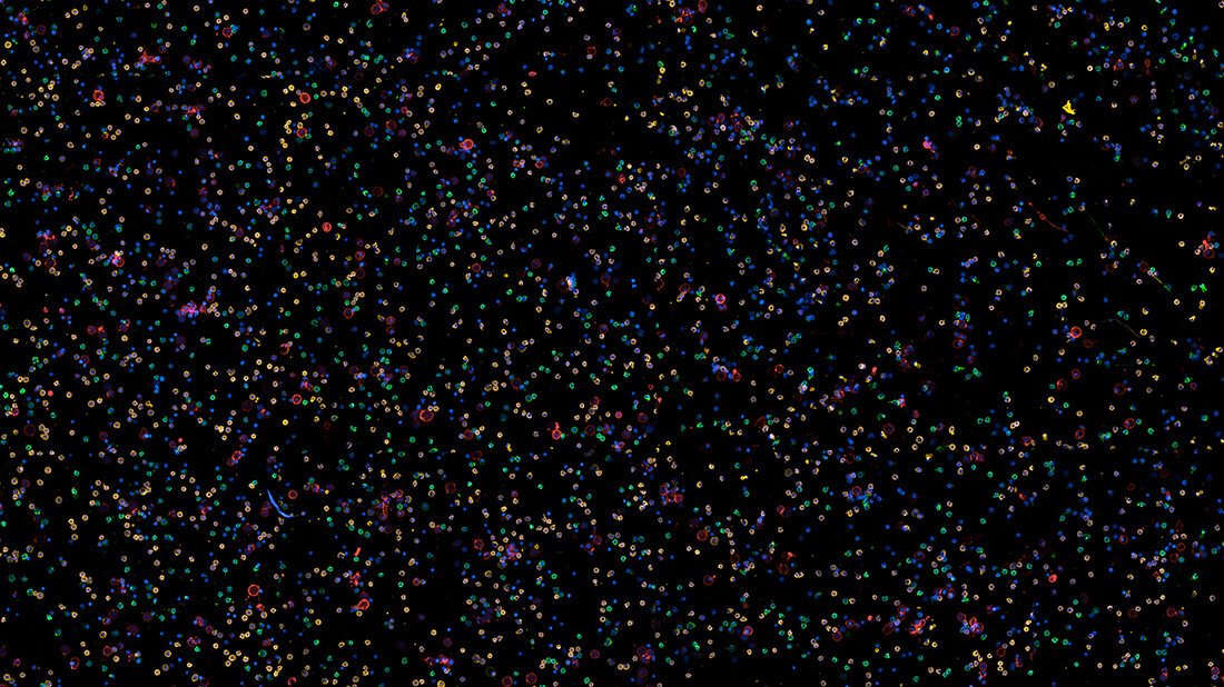 Blutzellen_Fluoreszenzmarker.jpg Blutbild Hochdurchsatz-Mikroskopiemethode