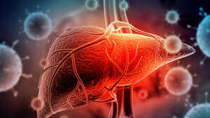 Häufung akuter Hepatitiden bei Kindern in Großbritannien