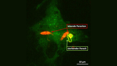 Leishmanien infizierter Makrophage 