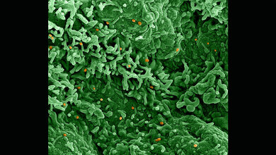 Monkeypox_virus_NIAID_creativecommons_org_licenses_by_2_0.jpg Affenpockenvirus