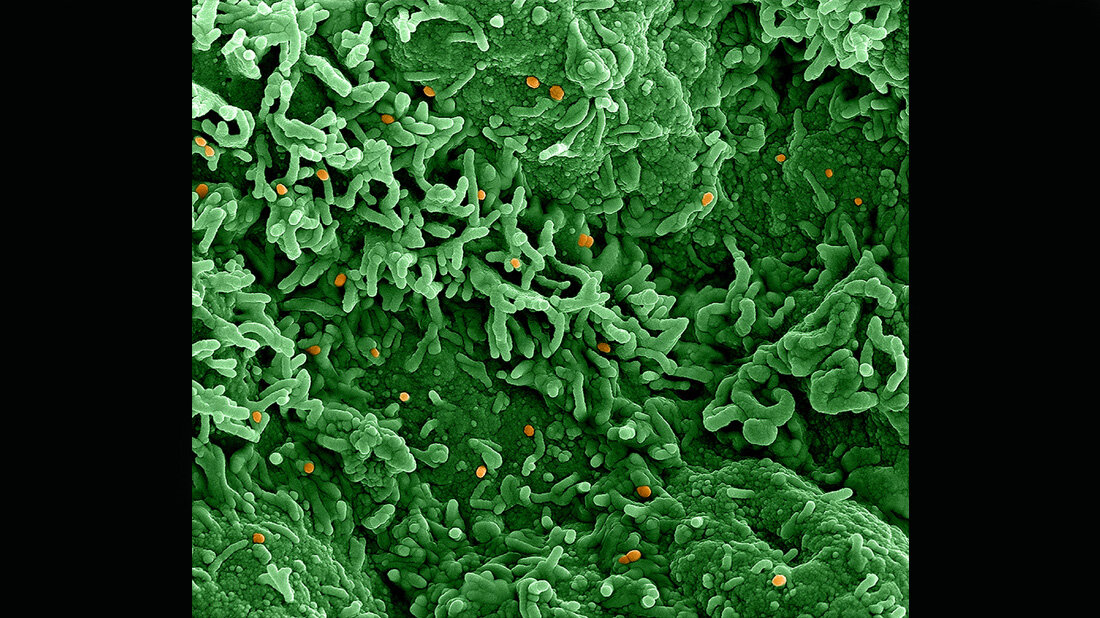 Monkeypox_virus_NIAID_creativecommons_org_licenses_by_2_0.jpg Affenpockenvirus