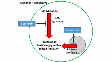 Schematische_Darstellung_eines_malignen_T_Lymphozyten_des_Sezary_Syndroms_PD_Dr_Karsten_Guelow.jpg