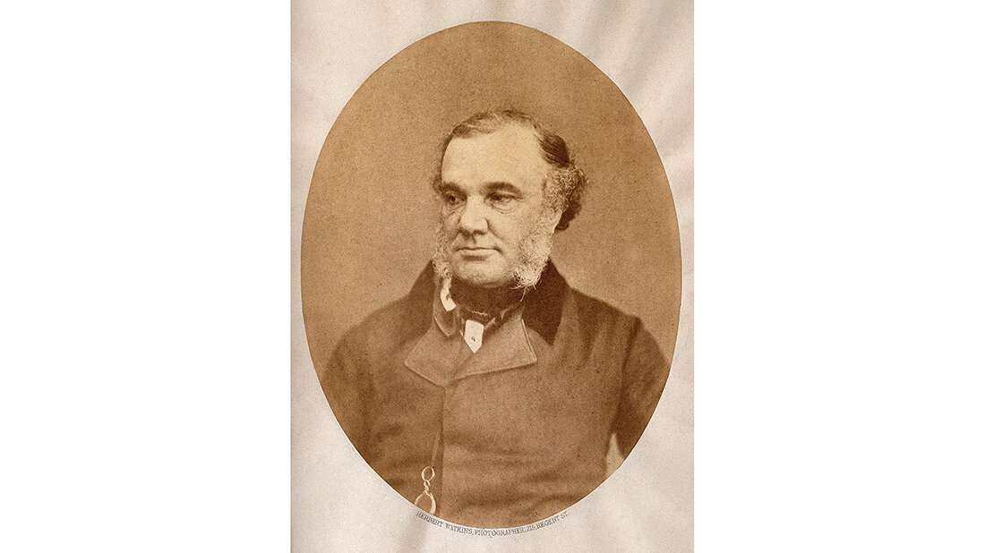 „Bronzekrankheit“: Erstbeschreibung der Nebenniereninsuffizienz Porträt von Thomas Addison, dem Erstbeschreiber der Nebenniereninsuffizienz