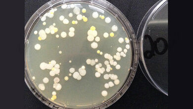 Hygieneprojekt Händehygiene