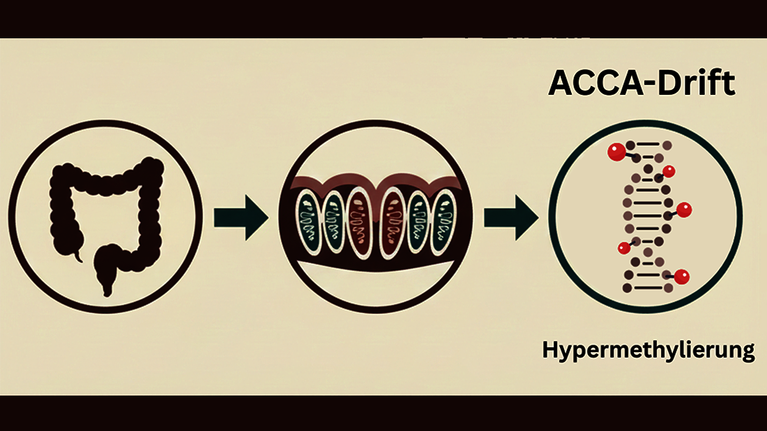 Schematische Darstellung des ACCA-Drifts: Vom Darm über mitochondriale Veränderungen zur DNA-Hypermethylierung