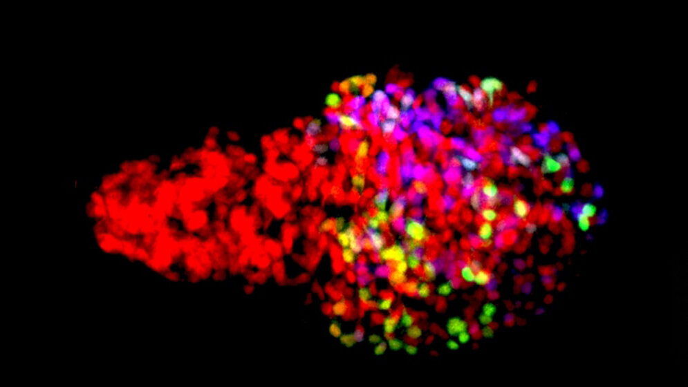 β –Zellen eines Zebrafisches