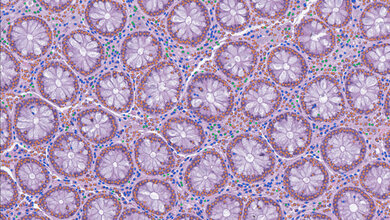 Zelldetektion mit LazySlide in menschlichem Dickdarmgewebe.