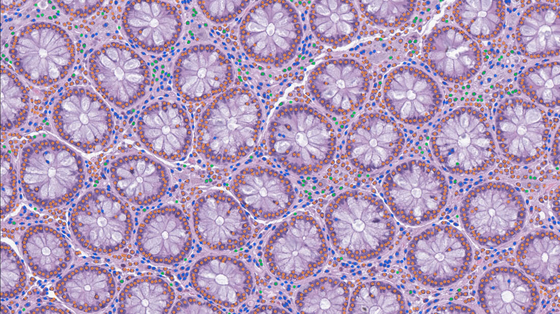 Zelldetektion mit LazySlide in menschlichem Dickdarmgewebe.