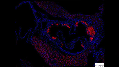 Immunofluoreszenzfärbung von atherosklerotischen Plaques 