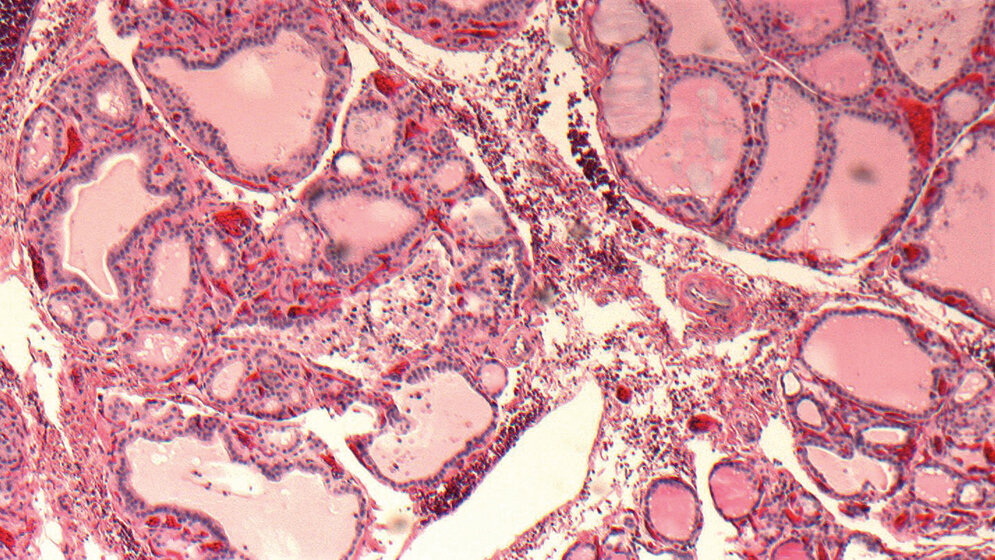 Labordiagnostik Die Schilddrüse