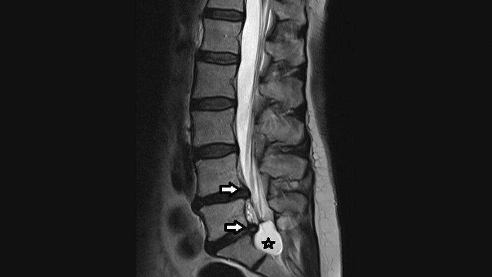 Anomalien und Normvarianten: Skelettale Veränderungen 3.19