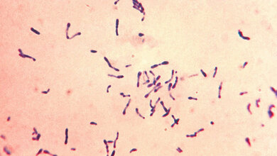 Corynebacterium diphtheriae