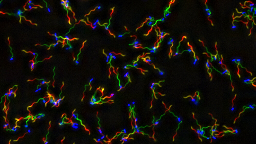 Salmonellen mit angefärbten Flagellen