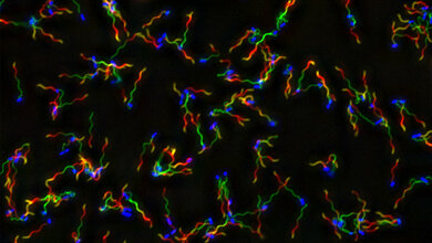 Salmonellen mit angefärbten Flagellen