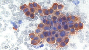 Immunzytochemische Diagnostik (2)