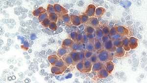 Immunzytochemische Diagnostik (2)