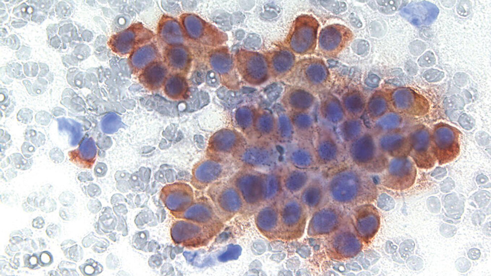 Laboratoriumsmedizin Immunzytochemische Diagnostik (2)
