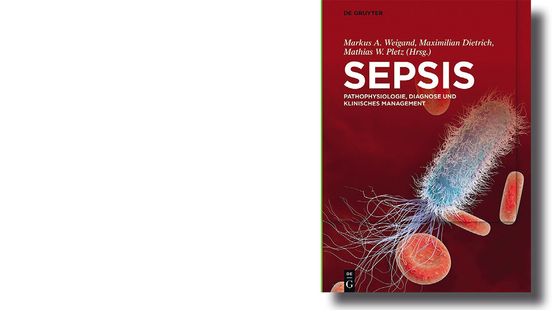 Cover des Buchs „Sepsis: Pathophysiologie, Diagnose und klinisches Management“