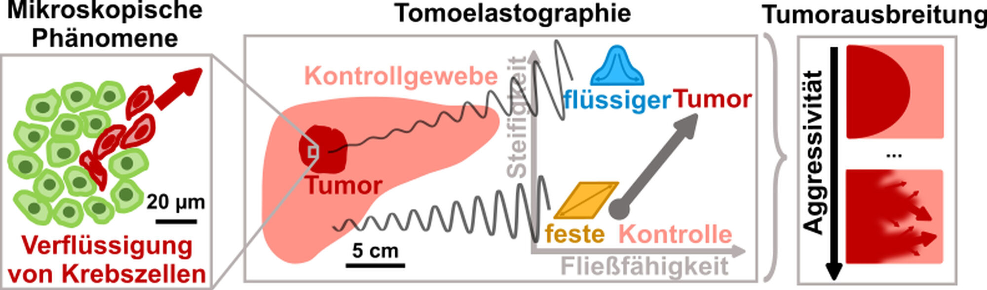 Tumor-assoziiert mikroskopische Effekte wie die Verflüssigung oder erhöhte Fließfähigkeit von Krebszellen