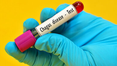 chagas-krankheit.jpg Chagras-Krankheit