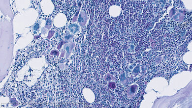 Laboratoriumsmedizin Thrombopoese (Teil 2)