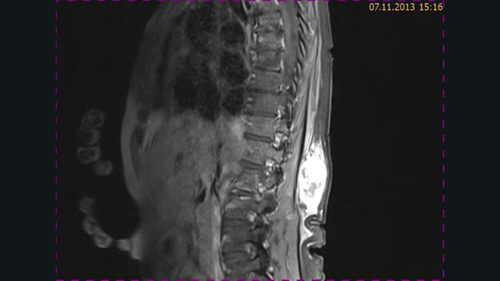 Schnittbilddiagnostik der Wirbelsäule (4.20)