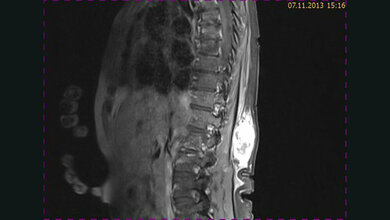 Schnittbilddiagnostik der Wirbelsäule (4.20)