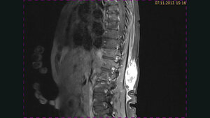 Schnittbilddiagnostik der Wirbelsäule (4.20)