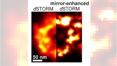 dSTORM-Bilder 