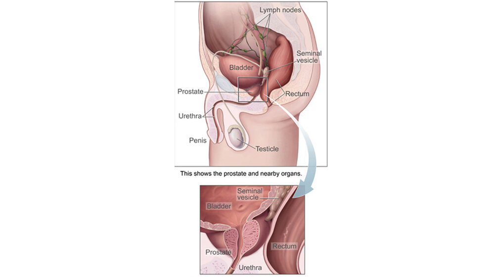 Hormonentzugstherapie 