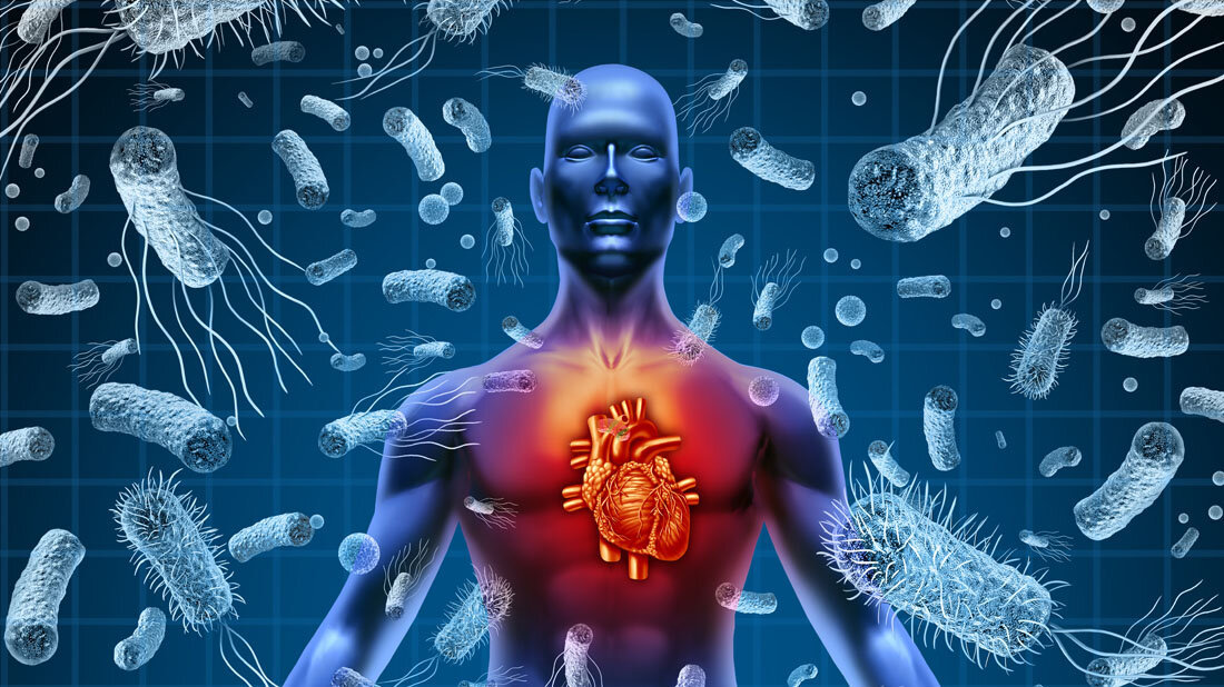 Sepsis_Autoantikoerper.jpg Ursache der Immunschwäche bei Sepsis wird erforscht