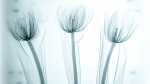 Technische und medizinische Störstrukturen im digitalen Mammogramm 