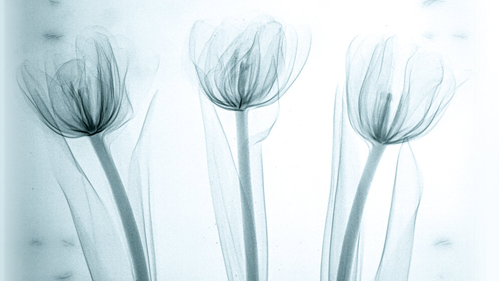 Technische und medizinische Störstrukturen im digitalen Mammogramm 