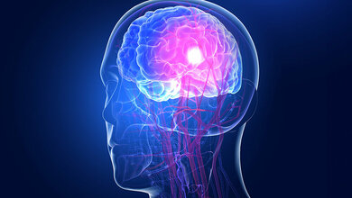 Arterien_Gehirn.jpg Arterien im Gehirn