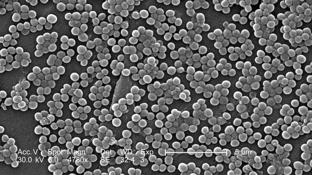 Ausschnitt_aus_einer_MRSA_Kolonie_CDC.jpg MRSA-Kolonie