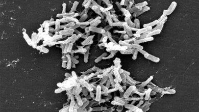 Clostridium difficile (von einer Stuhlprobe) 