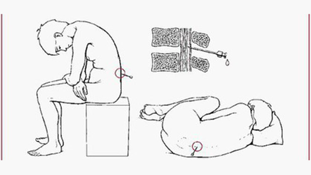 Funktionsdiagnostische und labortechnische Untersuchungen Neurologie