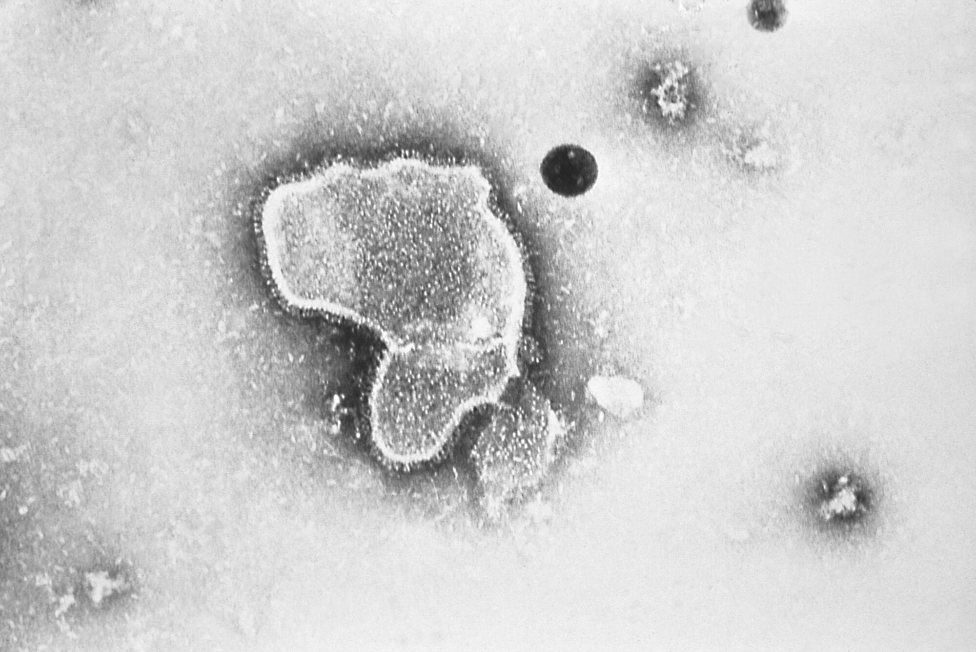 Respiratorische Synzytial-Virus (RSV) 
