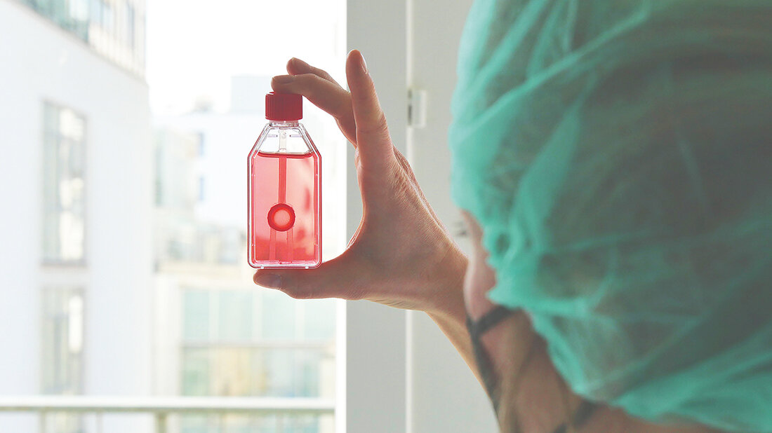 Foto eines Mediziners, der eine Flasche mit einem Augenhornhauttransplantat gegen das Licht hält