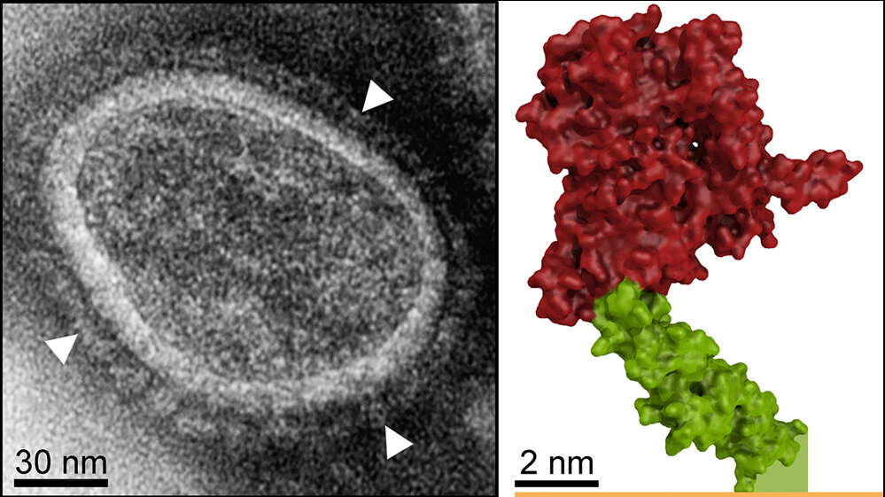 EM-Aufnahme der Genfähre mit Hüllproteinen 