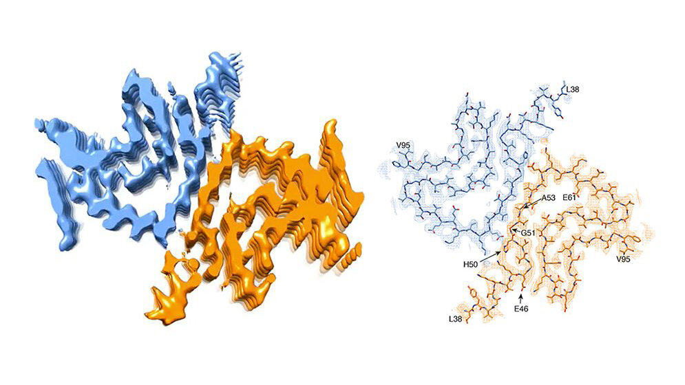 Querschnitt einer alpha-Synuclein-Fibrille.