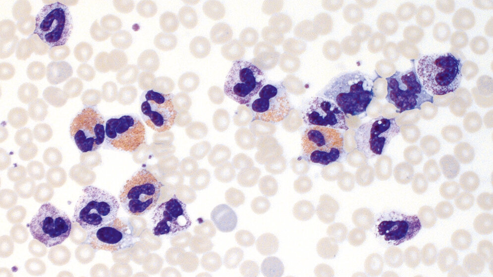 Hämatologie Granulopoese (Teil 2)