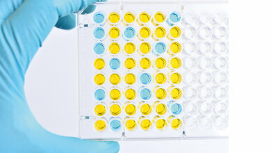 Repetitorium: Immunchemische Verfahren