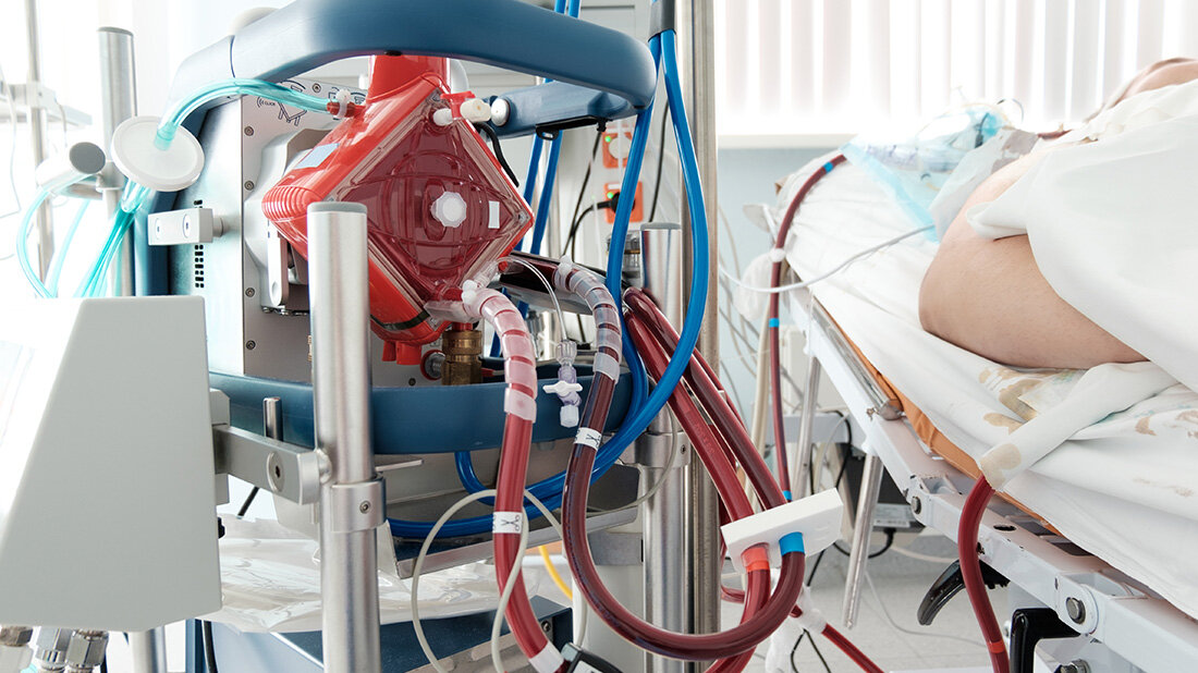 Kontaktstelle für Überlebende kritischen SARS-CoV-2-Infektionen, Spätfolgen der Corona-Sepsis 