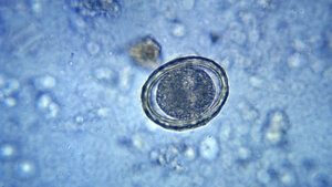 Nachweis intestinaler Würmer mittels koproskopischer Untersuchungen