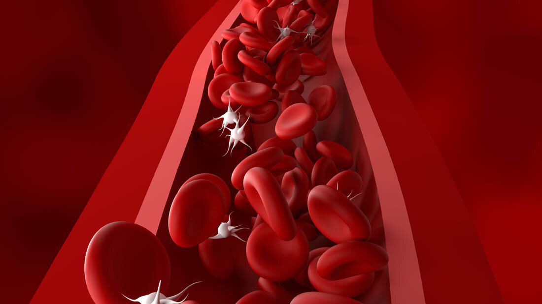 Thrombozytenzahl_verringert.jpg Symbolbild für Immunthrombozytopenie