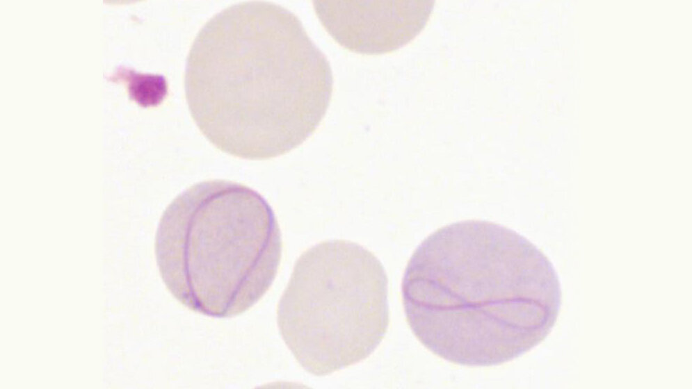Zwei Cabot-Ringe in Megalozyten